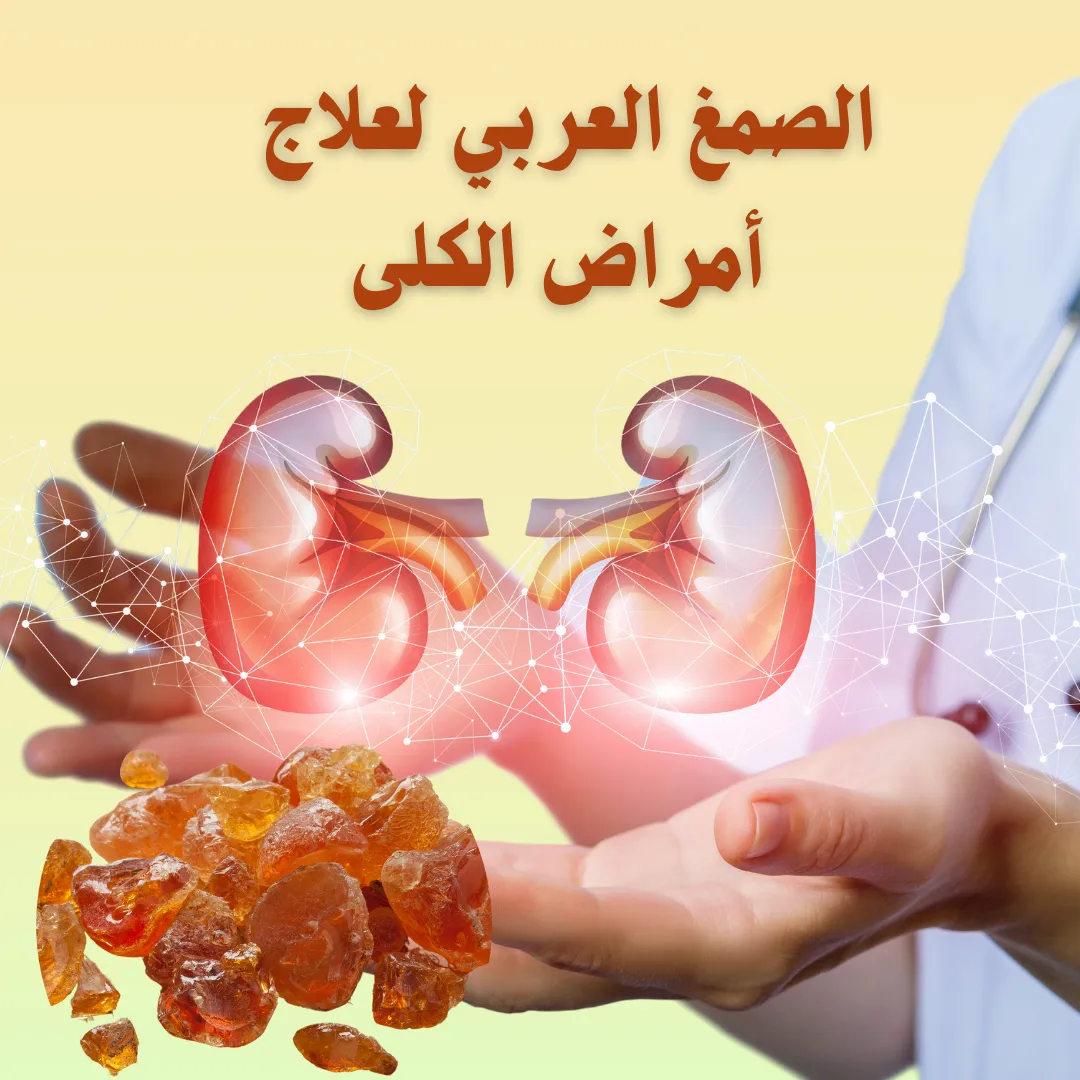 الصمغ العربي لعلاج أمراض الكلى